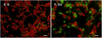 Mikrofotografie kultur zelené řasy Coccomyxa elongata. Vlevo prostředí s anorganickým rozpuštěným fosforem, vpravo s organickým fosforem. Červeně fluorescence chlorofylu, zeleně fluorescence buněk s fosfázovou aktivitou. Kredit: Vrba et al. (2018), F