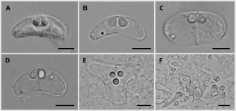 Různá stádia rybomorek ze slizounů. Kredit: Bartošová-Sojková et al. (2018), PLoS ONE.