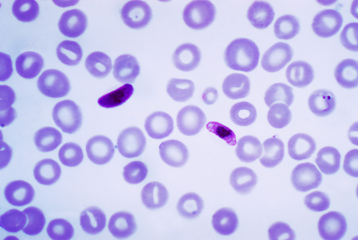 Původce malárie Plasmodium falciparum. Kredit: CDC/Mae Melvin