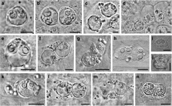 Rybomorky rodu Sphaerospora. Kredit: Patra et al. (2018), Parasites & Vectors.