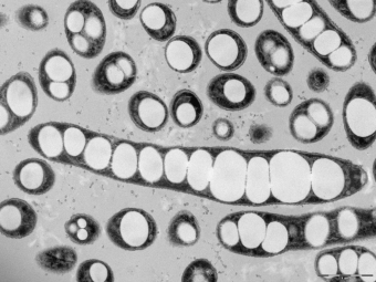 Betaproteobakterie Cupriavidus necator pěstované v kultivačním mediu. Kredit: J. Nebesářová.