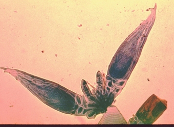 Mikrofotografie houby rodu Herpomyces. Kredit: Sergio Sanchez / Wikimedia Commons.