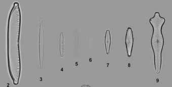 Některé z kmenů rozsivek zařazených do studie. Kredit: Hejduková et al. (2019).