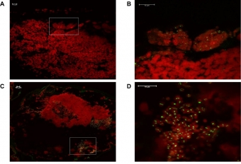 Bakteriocyty mšic na imunohistochemických snímcích. Kredit: Singh et al. 2020.