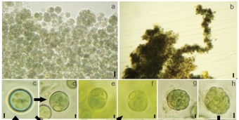 Komarekiella atlantica. Kredit: Hentschke et al. (2017) Fottea.