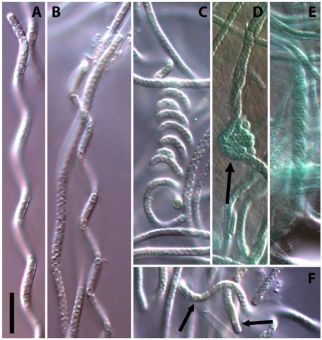 Obrázek: Nodosilinea chupicuarensis. Kredit: Vázquez-Martínez et al. (2018) Phytotaxa.