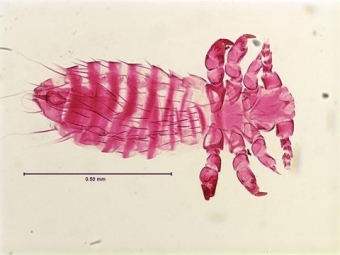 Veš Polyplax spinulosa. Kredit: K. C. Emerson Entomology Museum, Stillwater Oklahoma.